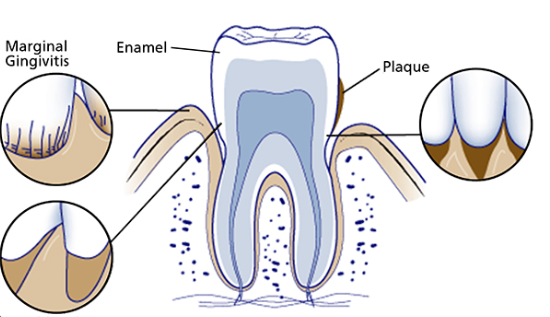 Understanding Teeth Sensitivity