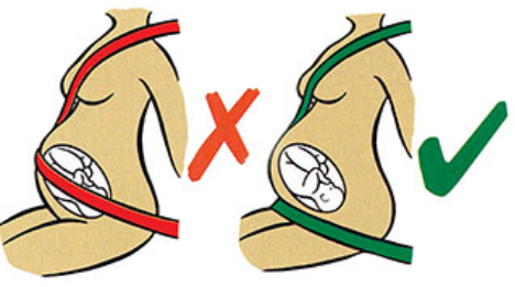 What Exactly Is a Pregnancy Seat Belt Positioner?