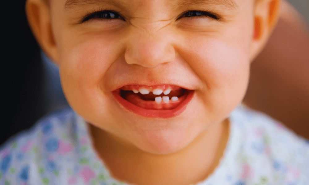 How Many Teeth Do Kids Have?